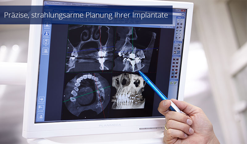 Digitale Volumentomographie (3D-DVT)